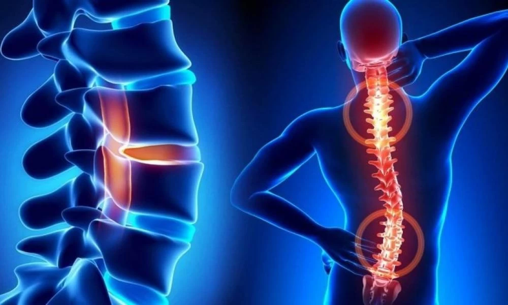 Tips για να ισιώσετε τη σπονδυλική σας στήλη xωρίς τη βοήθεια γιατρού